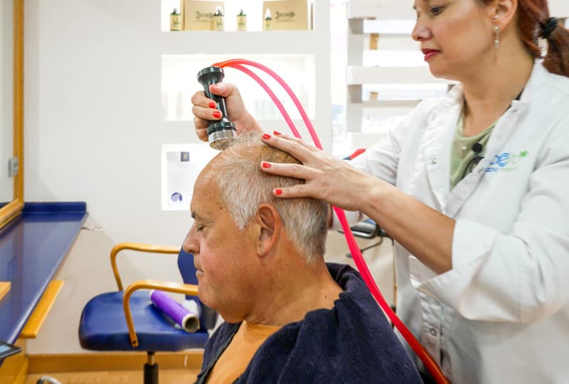 Crioterapia capilar