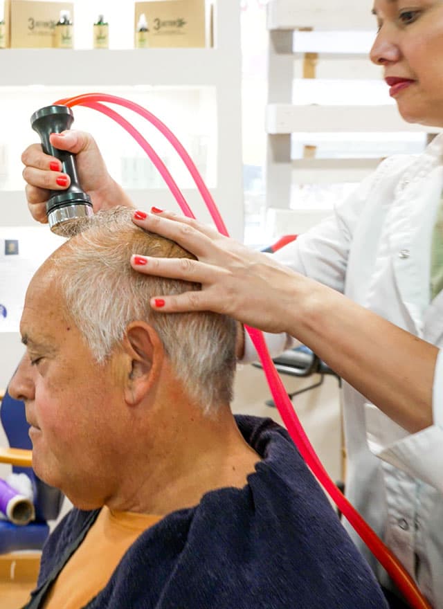 Crioterapia capilar en Vigo: la solución a la alopecia